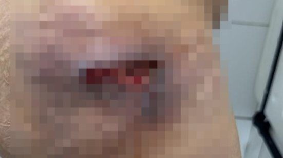 Foto: Cortesia ao TNH1