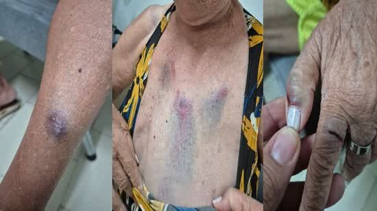 Ministério Público denuncia médica e representa filha adolescente por agressão e lesão contra idosa de 77 anos - Foto: Cortesia/PCAL