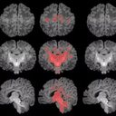 Foto: Photo: Pujol et al., 2025