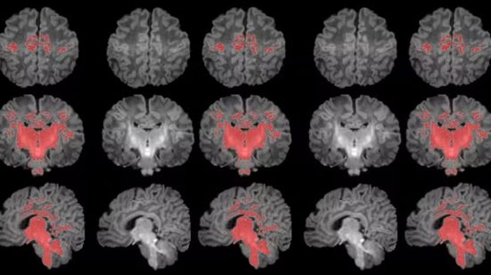 Foto: Photo: Pujol et al., 2025