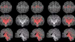 Foto: Photo: Pujol et al., 2025