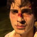 Fiuk aparece com rosto ensanguentado e assusta fãs: 'Precisa de tratamento' - Reprodução / Instagram