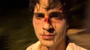 Fiuk aparece com rosto ensanguentado e assusta fãs: 'Precisa de tratamento' - Reprodução / Instagram