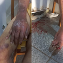 Idoso foi transferido para a Unidade de Emergência - Divulgação / Polícia Civil