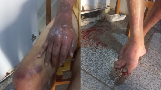 Idoso foi transferido para a Unidade de Emergência - Divulgação / Polícia Civil