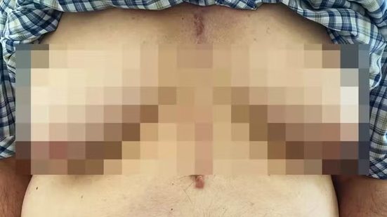 Foto: New England Journal of Medicine