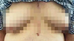 Foto: New England Journal of Medicine