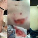 Foto: Acervo Pessoal