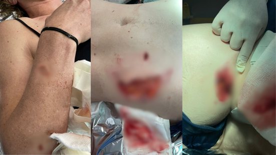 Foto: Acervo Pessoal