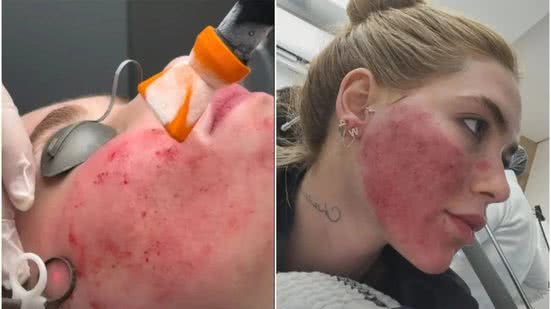 Foto: Reprodução/Redes Sociais