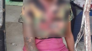 Rosana dos Santos chegou a ser socorrida, mas não resistiu aos ferimentos - Foto: Cortesia ao TNH1