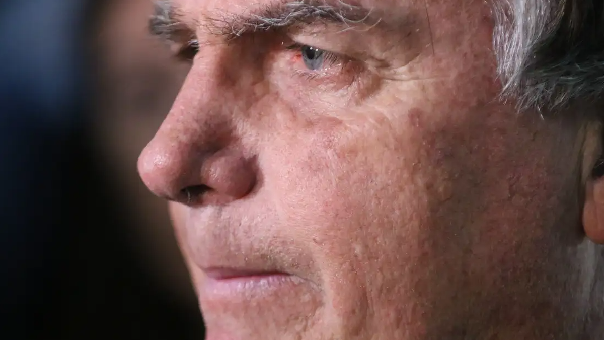 Após ordem de Moraes, defesa apresenta pedido de exame médico de Bolsonaro