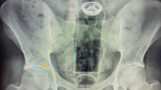 Foto: @danniellbrosco