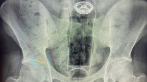 Foto: @danniellbrosco