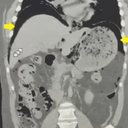 Foto: Carlos I Zaldo Arredondo/The Cureus Journal of Medical Science