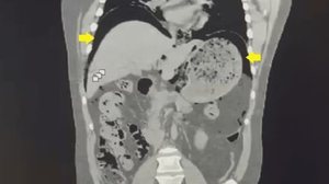 Foto: Carlos I Zaldo Arredondo/The Cureus Journal of Medical Science