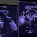 Foto: Reprodução/Redes Sociais