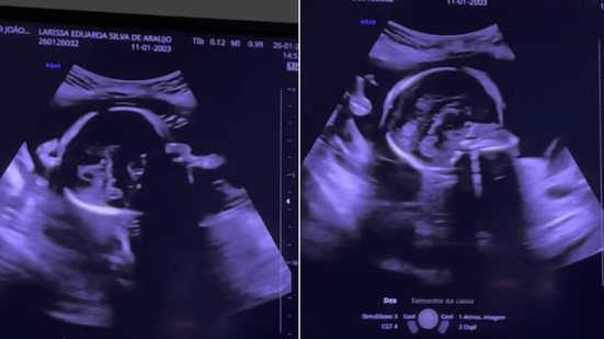 Foto: Reprodução/Redes Sociais