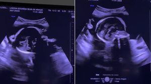 Foto: Reprodução/Redes Sociais