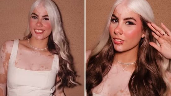 Foto: Reprodução/Redes Sociais