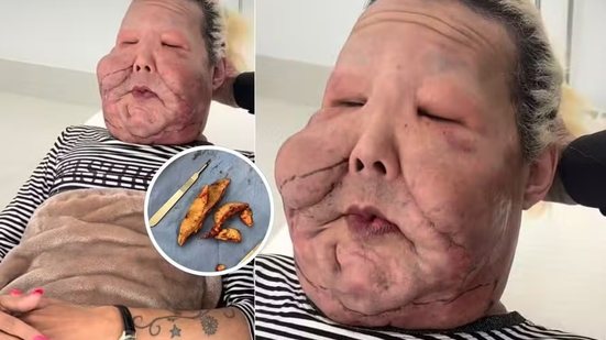 Reprodução/Redes sociais