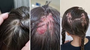 Foto: Reprodução/Redes Sociais