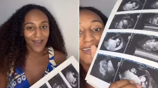 Foto: Reprodução/Redes Sociais