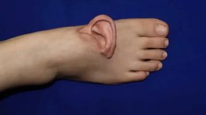 Foto: Divulgação/Shandong Provincial Hospital