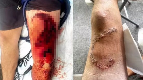 Foto: Reprodução/Redes Sociais