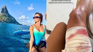 Foto: Reprodução/Redes Sociais