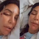 Ivete Sangalo surge em hospital com machucados no rosto e relata susto - Reprodução / Instagram