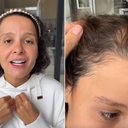 Maiara, da dupla com Maraisa, desabafa sobre alopécia - Reprodução / Instagram