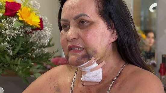 Foto: Cacá Trovó/EPTV