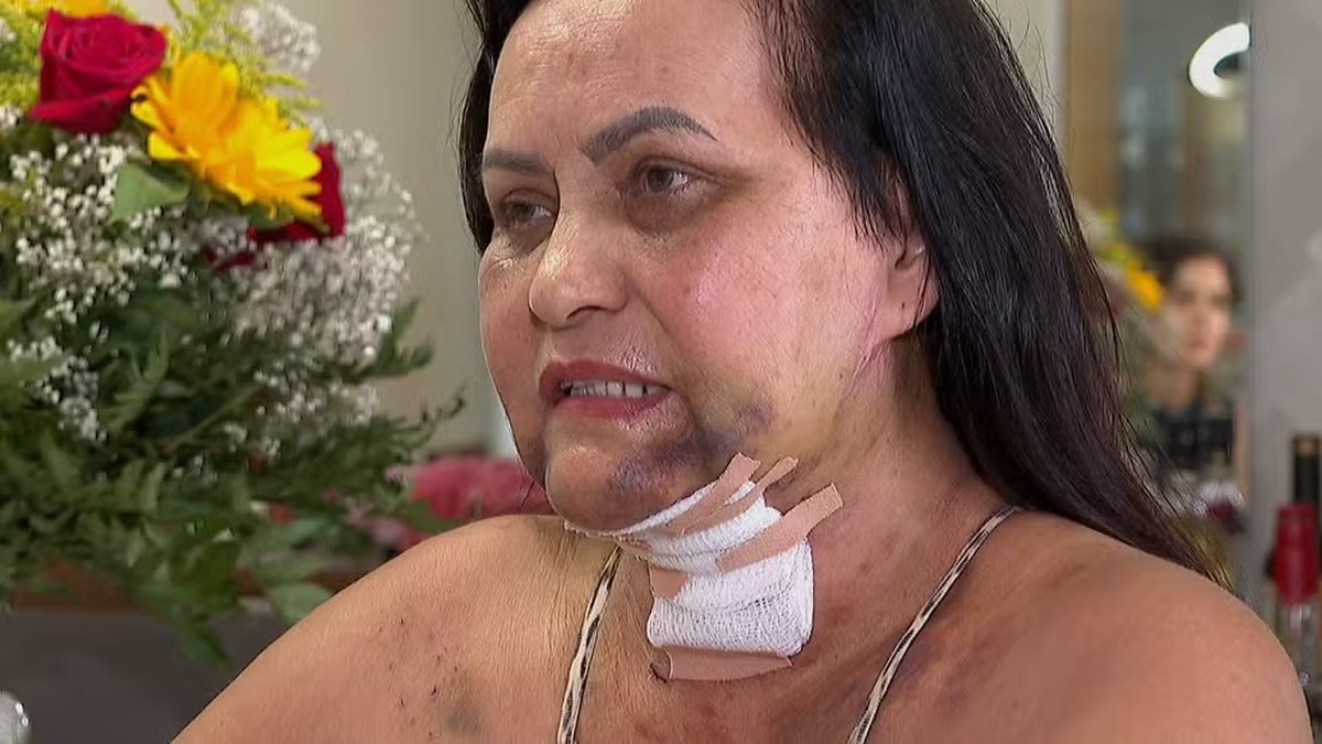 Laudo aponta deformidade permanente em mulher que fez procedimento estético com dentista