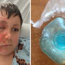 Foto: Reprodução/Redes Sociasi