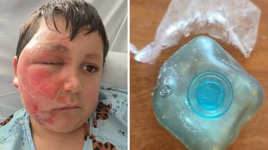 Foto: Reprodução/Redes Sociasi