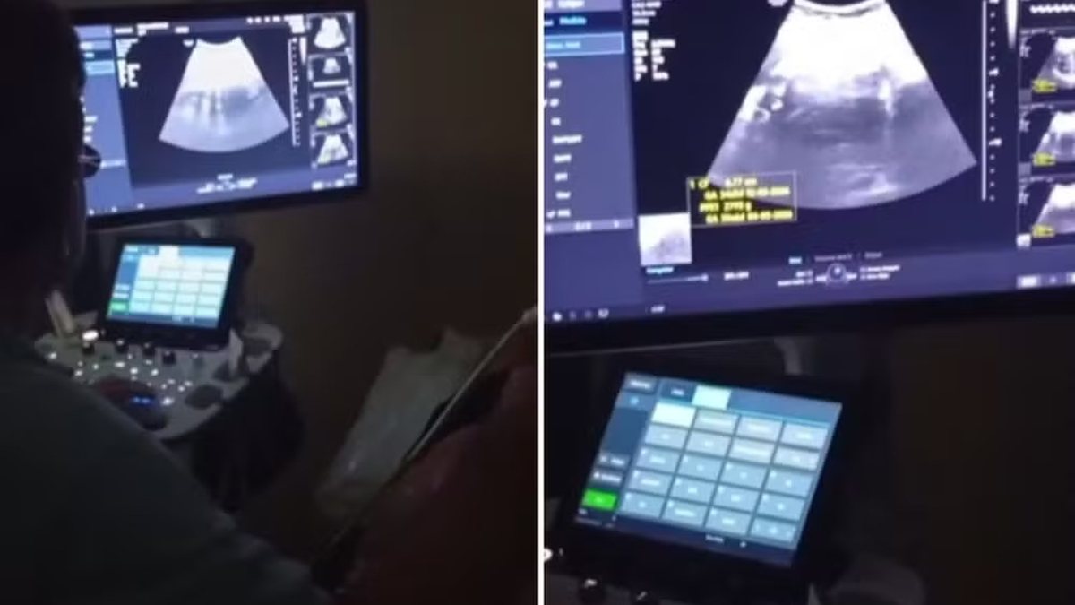 Dor no estômago leva mulher a exame e ultrassom revela gravidez de oito meses