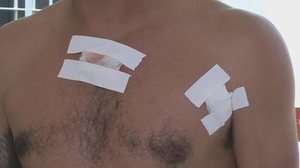 Vítima sobreviveu ao atentado - Reprodução / TV Pajuçara