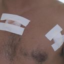 Vítima sobreviveu ao atentado - Reprodução/TV Pajuçara