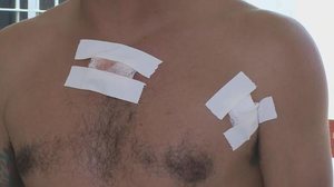 Vítima sobreviveu ao atentado - Reprodução/TV Pajuçara