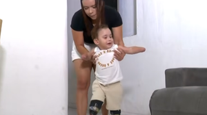 Noah Gabriel sofreu graves complicações que resultaram em múltiplas amputações. - Foto: Reprodução/TV Pajuçara