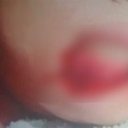 Mulher tem lábio arrancado por ex-companheiro em Viçosa - Reprodução