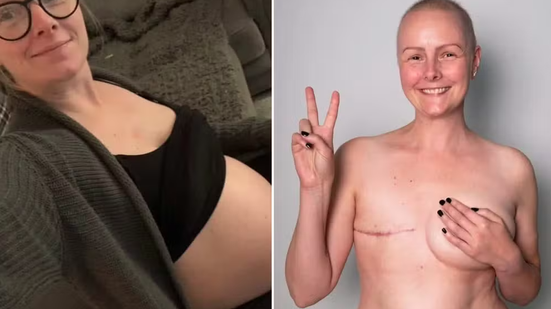 Mulher descobre câncer incurável após ter alteração nos seios durante a gravidez