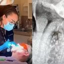 Imagem Brasileira presa nos EUA nega ter tratado canal de paciente: "Nunca falei que sou dentista"
