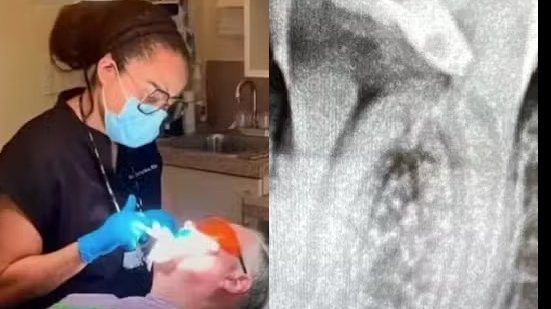 Imagem Brasileira presa nos EUA nega ter tratado canal de paciente: "Nunca falei que sou dentista"