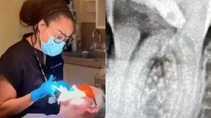 Imagem Brasileira presa nos EUA nega ter tratado canal de paciente: "Nunca falei que sou dentista"