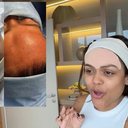 Camila Loures retira veia na testa - Reprodução / Redes sociais