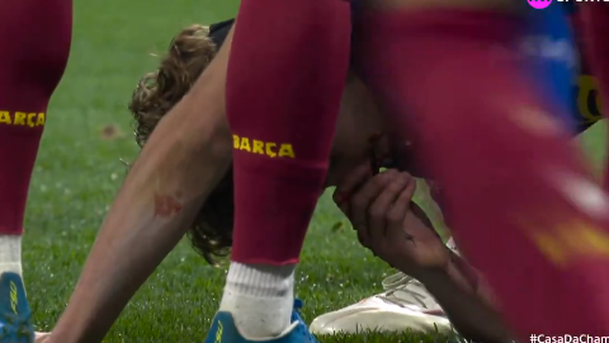 IMAGENS FORTES: jogador do Barcelona sangra em campo após choque com goleiro
