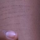 Marcas da violência no corpo da vítima, que não será identificada na reportagem - Reprodução / TV Pajuçara