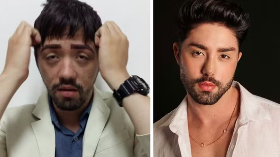 Reprodução/Redes Sociais